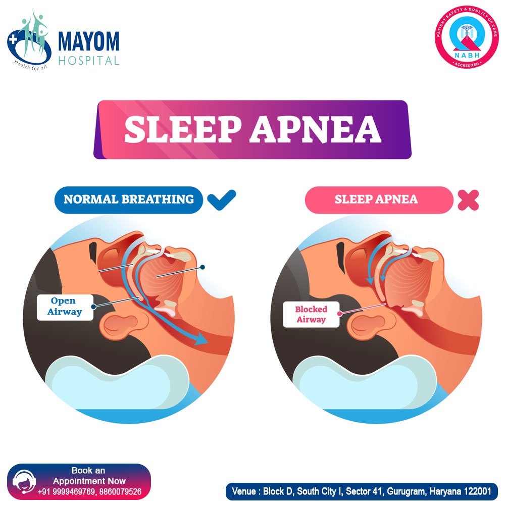 How Do ENTs Treat Sleep Apnea?