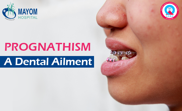 Prognathism: A Dental Ailment