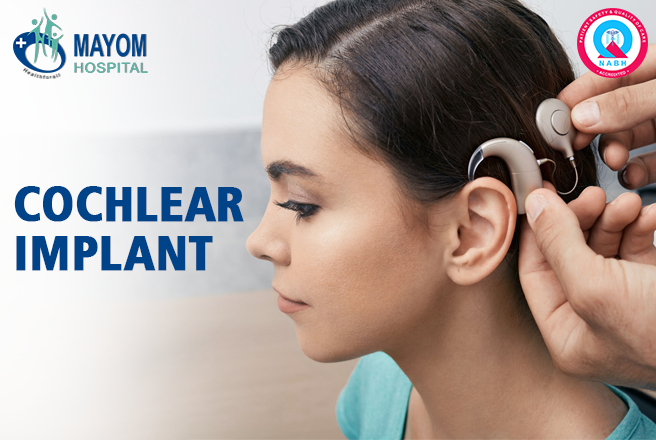 Cochlear Implant