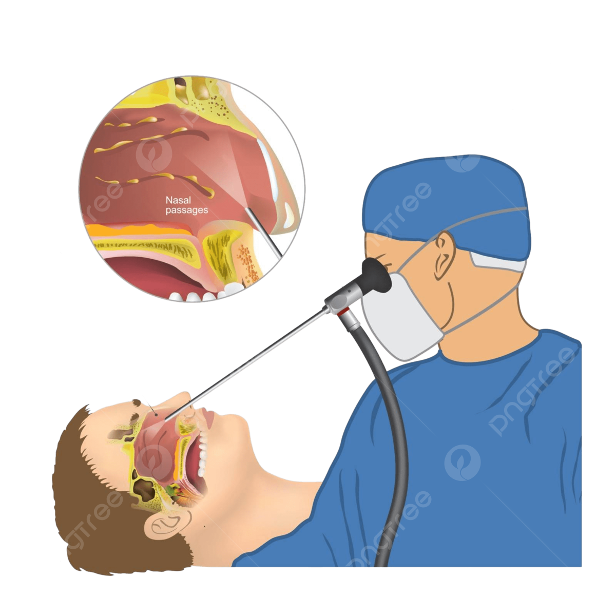 Sinus Surgery 