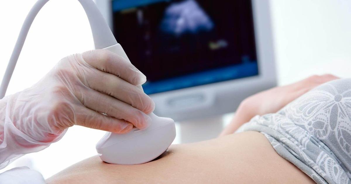 Ultrasound
