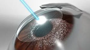 LASIK Surgery in Gurgaon – Best Eye Surgery Hospital for Clear Vision